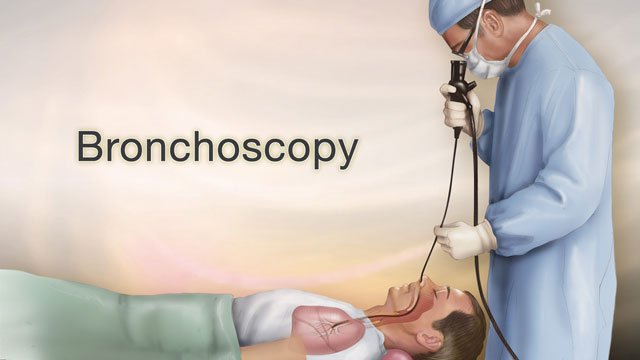 rigid bronchoscopy
