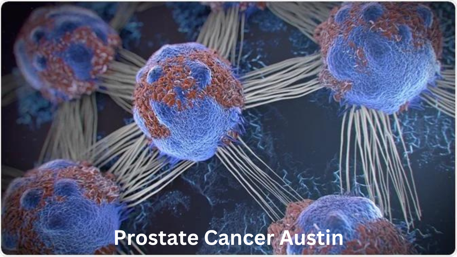 Prostate Cancer Austin