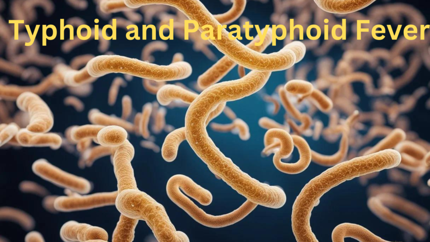 Typhoid and Paratyphoid Fever